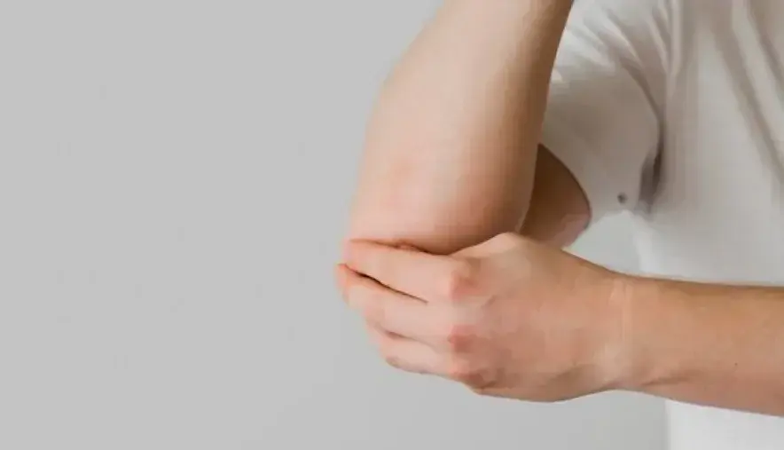 Ilustrasu kulit gatal karena alergi. Foto: Freepik