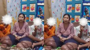  ibu Rumah Tangga Misri, dari Desa Sende, Arjawinangun, Cirebon. menderita sakit kaki Gajah.